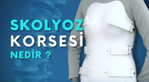 Skolyoz Nedir?